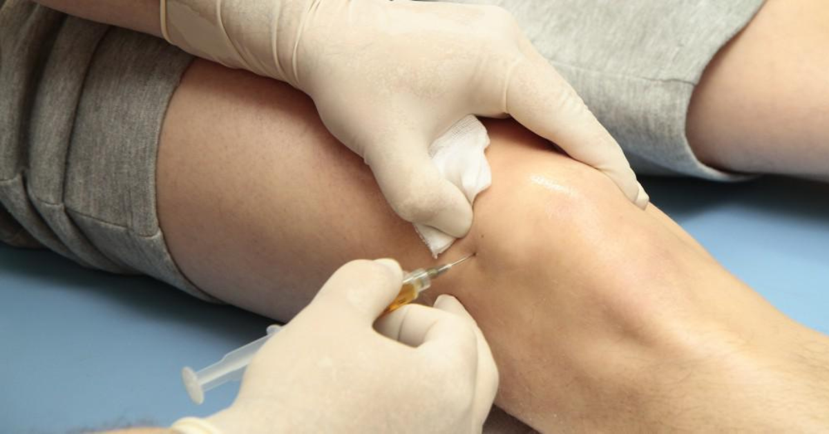 PRP Therapy in Orthopaedics: Healing with Your Own Platelets
